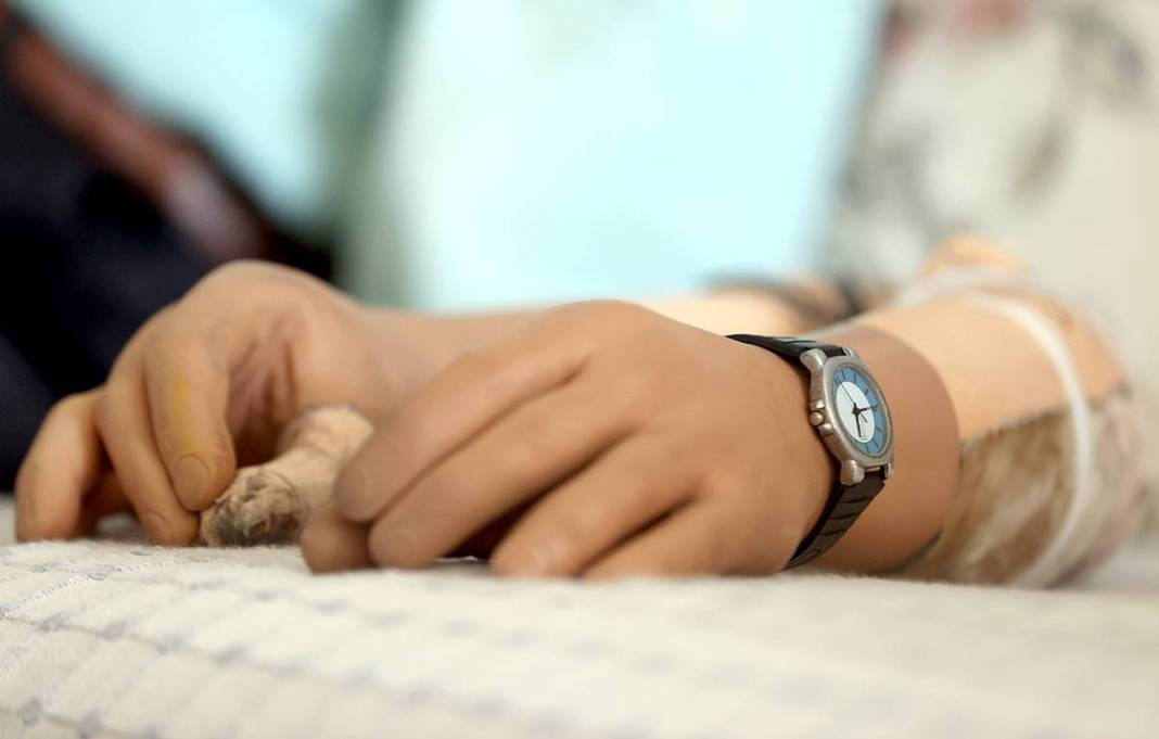 Protez kollarıyla diğer çiftçilere 30 yıldır taş çıkartıyor! Engelli çiftçinin azmi takdir topluyor 11